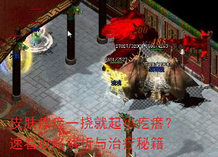 皮肤痒痒一挠就起小疙瘩?速看攻略解析与治疗秘籍 皮肤痒痒一挠就起小疙瘩?速看攻略解析与治疗秘籍